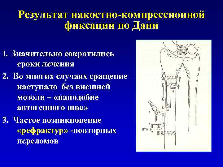 Направленная костная регенерация презентация