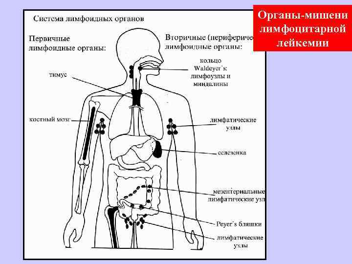 Органы-мишени лимфоцитарной лейкемии 
