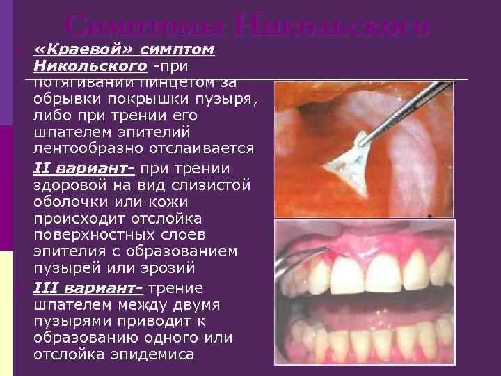 Приворот по фото симптомы