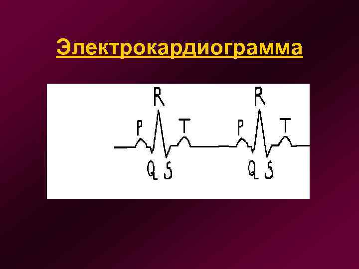 Электрокардиограмма 