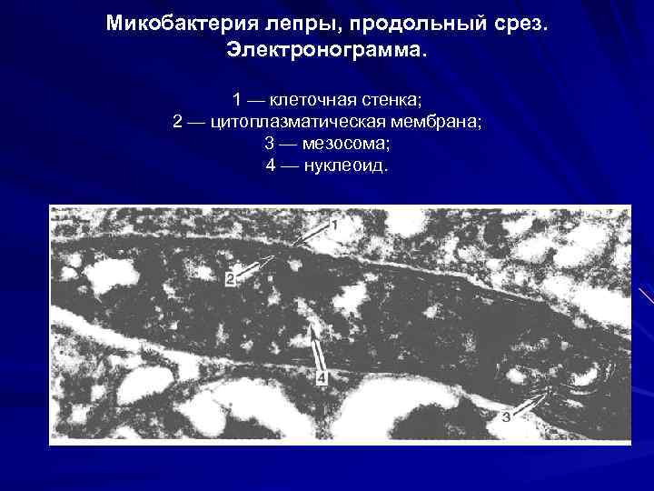 Микобактерия лепры, продольный срез. Электронограмма. 1 — клеточная стенка; 2 — цитоплазматическая мембрана; 3