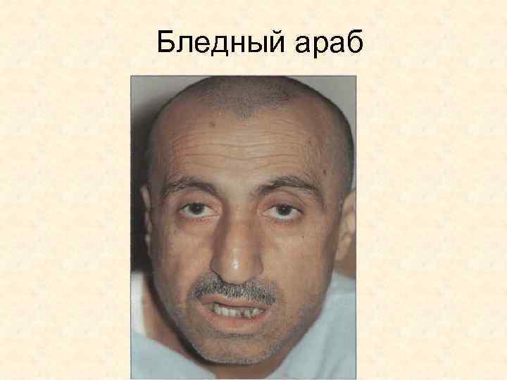 Бледный араб 