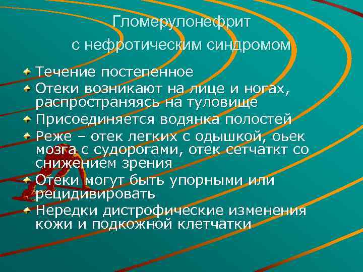 Гломерулонефрит с нефротическим синдромом Течение постепенное Отеки возникают на лице и ногах, распространяясь на
