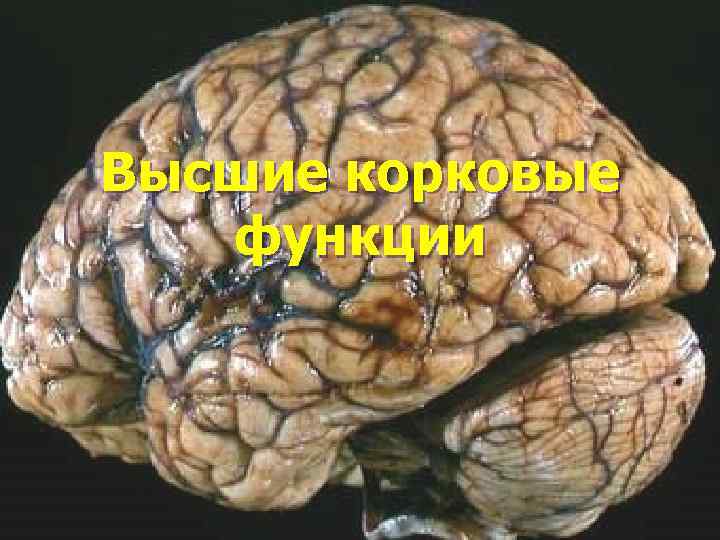 Высшие корковые функции 