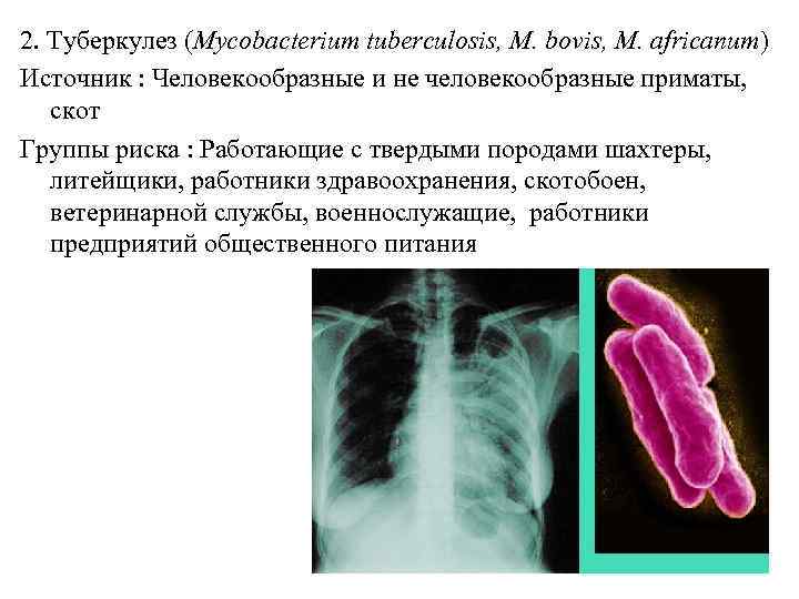 2. Туберкулез (Mycobacterium tuberculosis, M. bovis, M. africanum) Источник : Человекообразные и не человекообразные