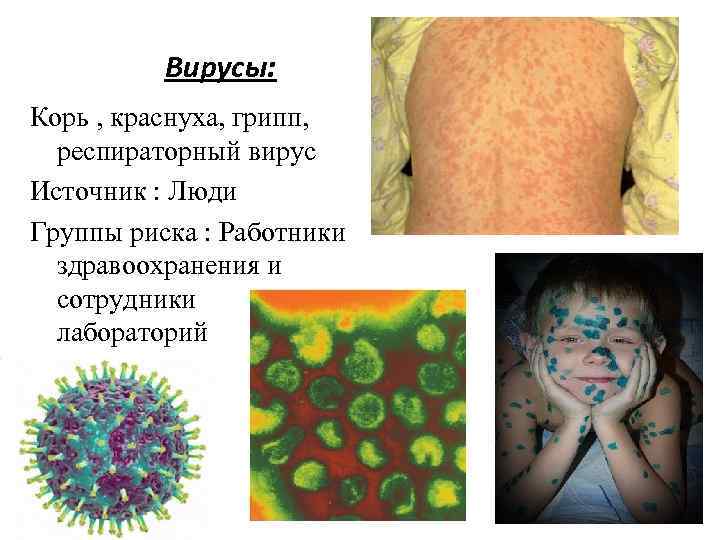Вирусы: Корь , краснуха, грипп, респираторный вирус Источник : Люди Группы риска : Работники