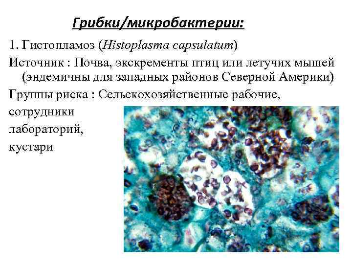 Грибки/микробактерии: 1. Гистопламоз (Histoplasma capsulatum) Источник : Почва, экскременты птиц или летучих мышей (эндемичны