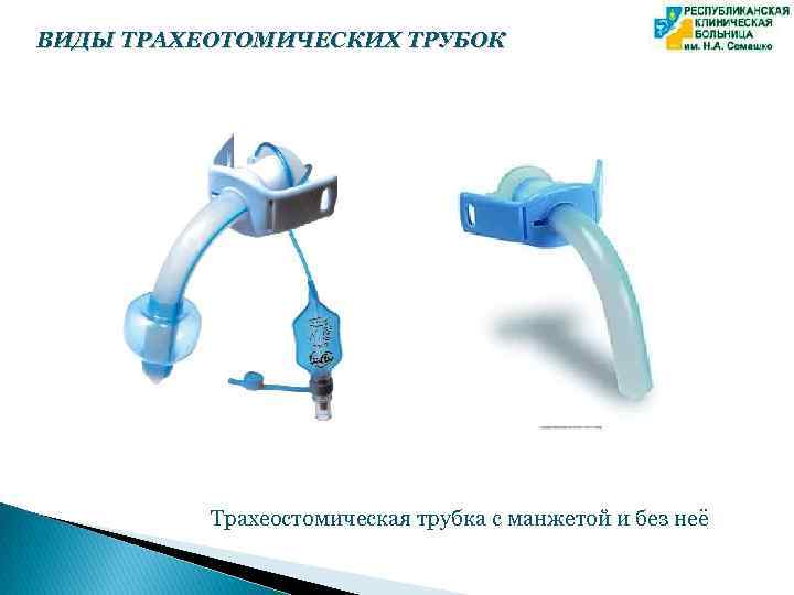 ВИДЫ ТРАХЕОТОМИЧЕСКИХ ТРУБОК Трахеостомическая трубка с манжетой и без неё 
