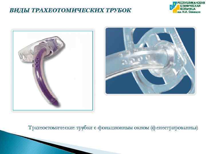 ВИДЫ ТРАХЕОТОМИЧЕСКИХ ТРУБОК Трахеостомические трубки с фонационным окном (фенестрированная) 