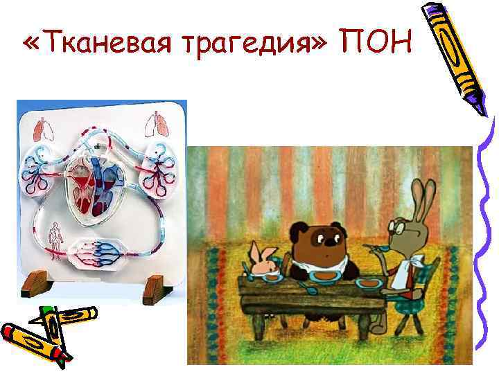  «Тканевая трагедия» ПОН 