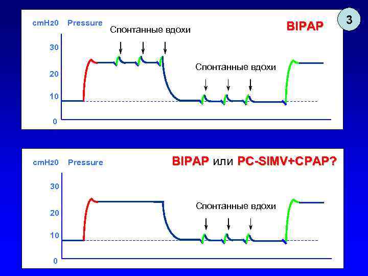 cm. H 20 Pressure BIPAP Спонтанные вдохи 30 Спонтанные вдохи 20 10 0 cm.