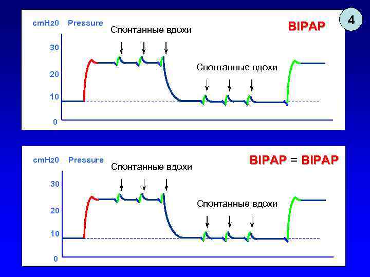 cm. H 20 Pressure BIPAP Спонтанные вдохи 30 Спонтанные вдохи 20 10 0 cm.