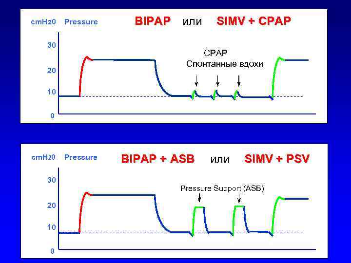 cm. H 20 Pressure 30 BIPAP или SIMV + CPAP Спонтанные вдохи 20 10