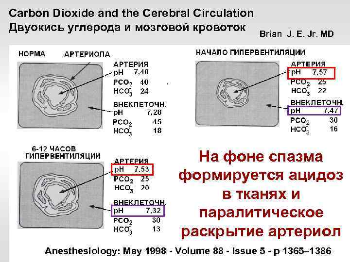 Carbon Dioxide and the Cerebral Circulation Двуокись углерода и мозговой кровоток Brian J. E.