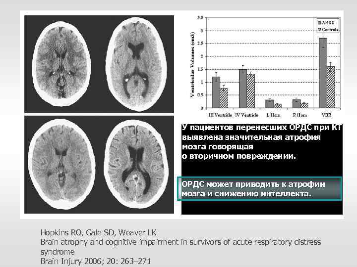 У пациентов перенесших ОРДС при КТ выявлена значительная атрофия мозга говорящая о вторичном повреждении.