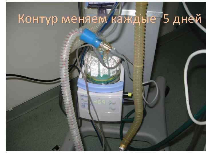 Контур меняем каждые 5 дней 