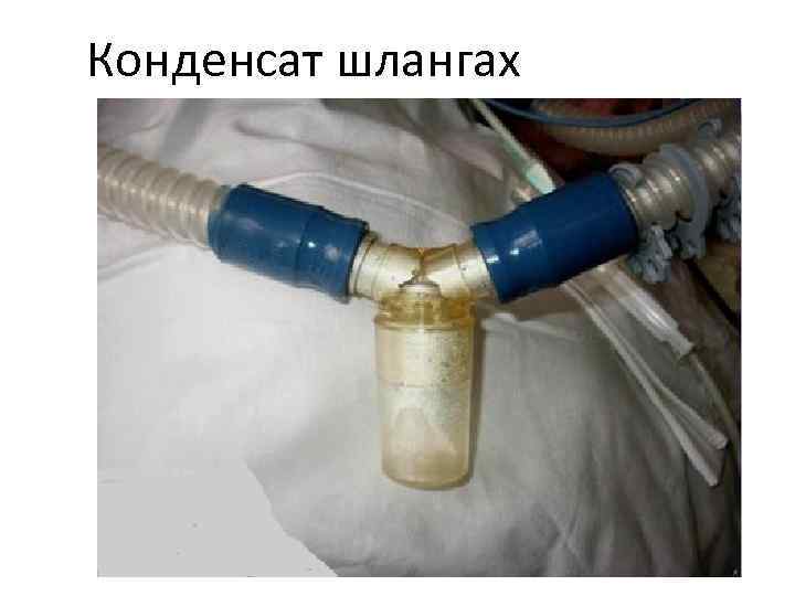 Конденсат шлангах 