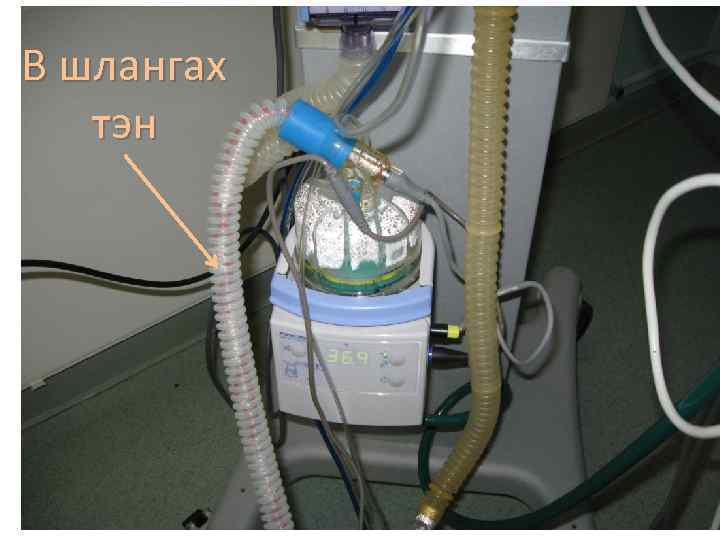 В шлангах тэн 