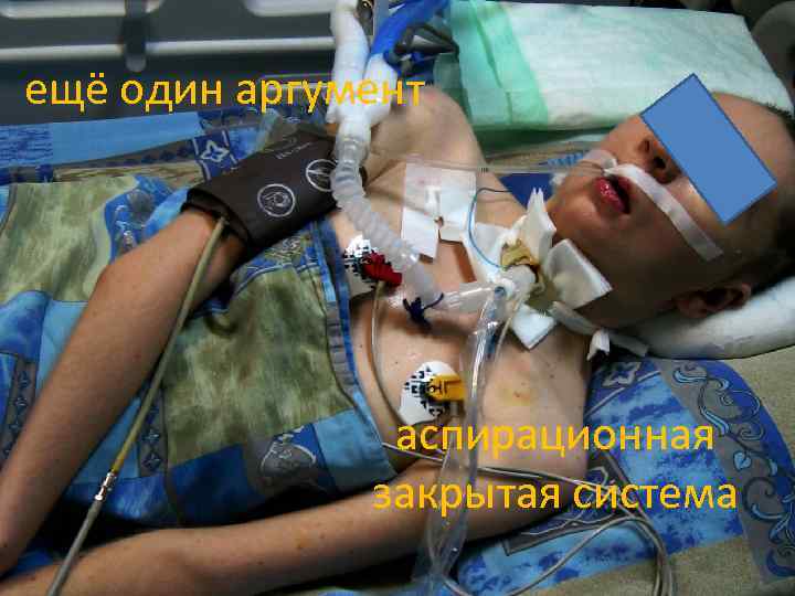 ещё один аргумент аспирационная закрытая система 