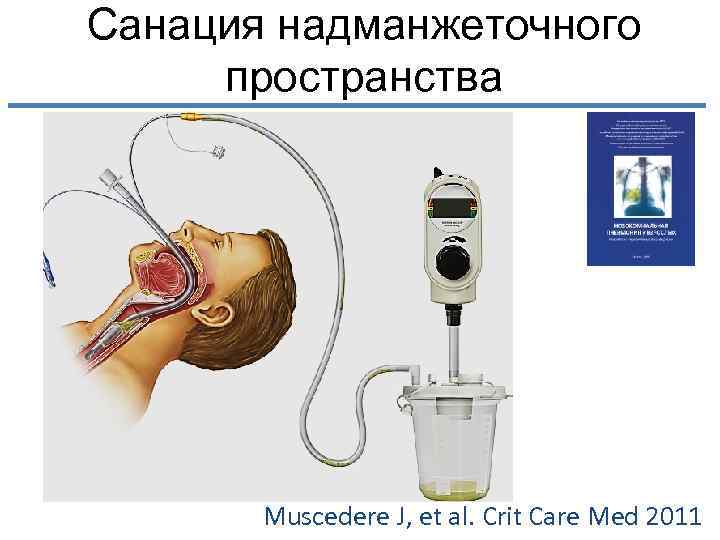 Санация это. Санация надманжеточного пространства. Трахеостома для санации надманжеточного пространства. Что такое надманжеточного пространства. Санация при воспалении.