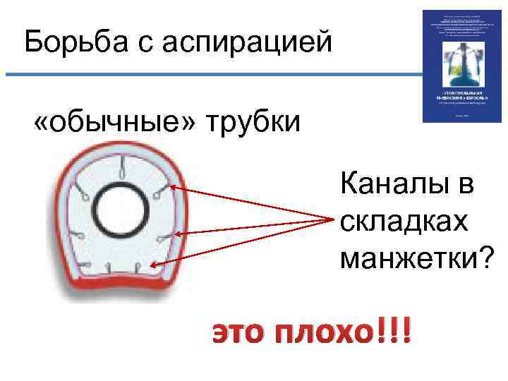 Борьба с аспирацией «обычные» трубки Каналы в складках манжетки? это плохо!!! 