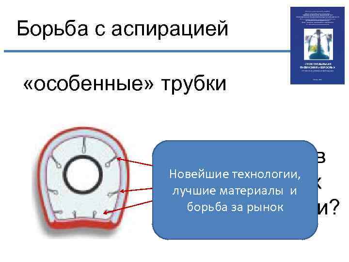 Борьба с аспирацией «особенные» трубки Каналы в Новейшие технологии, складках лучшие материалы и борьба