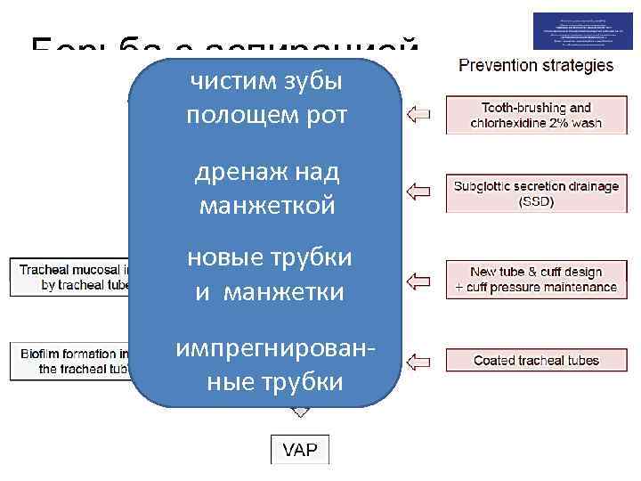 Борьба с аспирацией чистим зубы полощем рот «особенные» трубки дренаж над манжеткой новые трубки