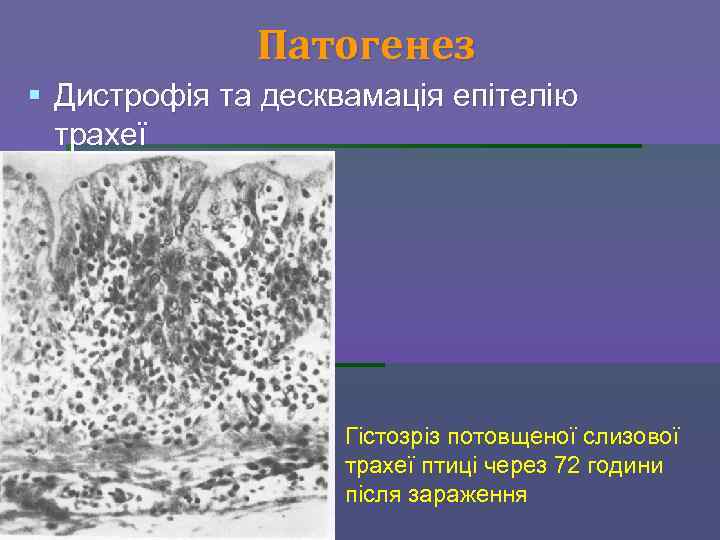 Патогенез § Дистрофія та десквамація епітелію трахеї Гістозріз потовщеної слизової трахеї птиці через 72