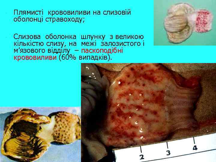 - Плямисті крововиливи на слизовій оболонці стравоходу; - Слизова оболонка шлунку з великою кількістю