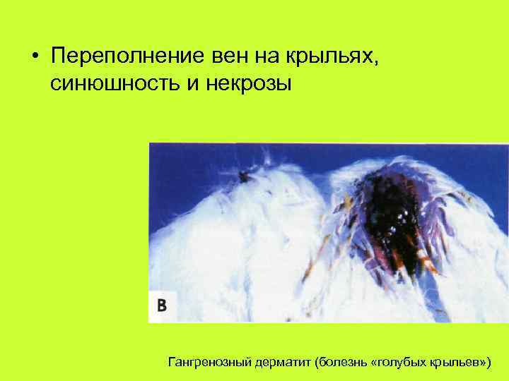  • Переполнение вен на крыльях, синюшность и некрозы Гангренозный дерматит (болезнь «голубых крыльев»