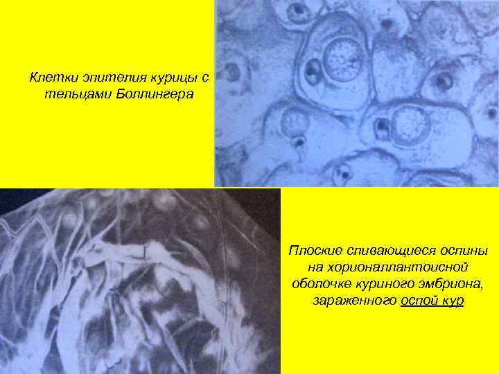 Клетки эпителия курицы с тельцами Боллингера Плоские сливающиеся оспины на хорионаллантоисной оболочке куриного эмбриона,
