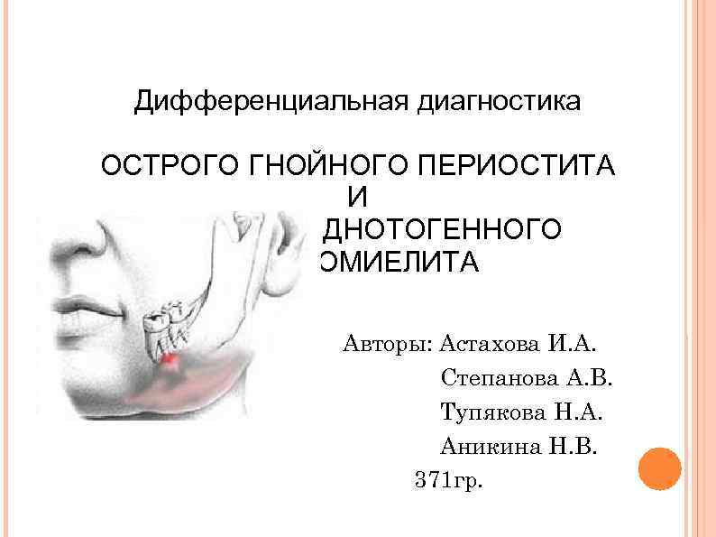Дифференциальная диагностика ОСТРОГО ГНОЙНОГО ПЕРИОСТИТА И ОСТРОГО ОДНОТОГЕННОГО ОСТЕОМИЕЛИТА Авторы: Астахова И. А. Степанова