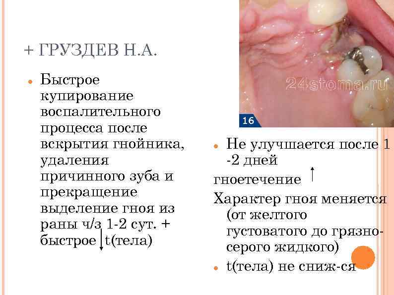 + ГРУЗДЕВ Н. А. Быстрое купирование воспалительного процесса после вскрытия гнойника, удаления причинного зуба
