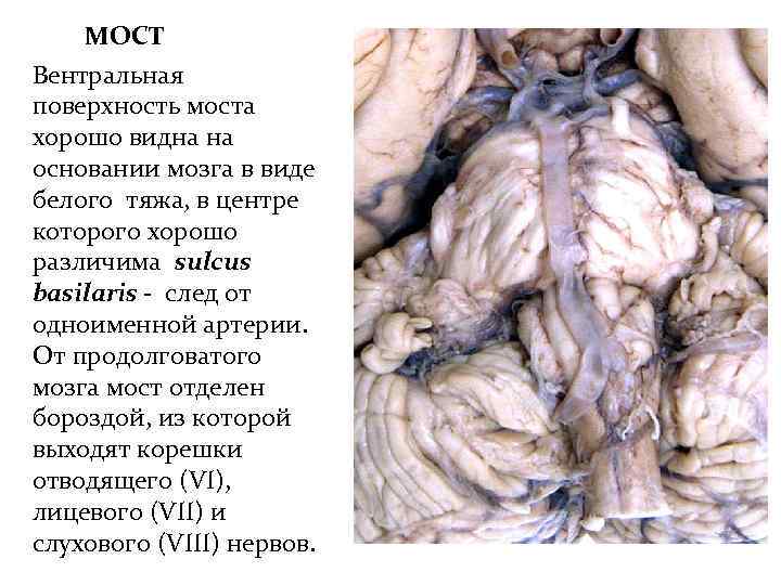 МОСТ Вентральная поверхность моста хорошо видна на основании мозга в виде белого тяжа, в