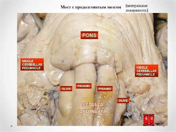 (вентральная поверхность) 