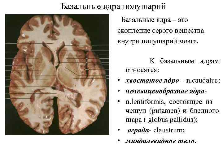 Базальные ядра полушарий Базальные ядра – это скопление серого вещества внутри полушарий мозга. •