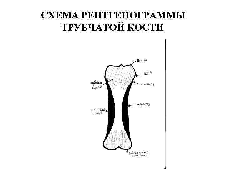 Схема трубчатой кости