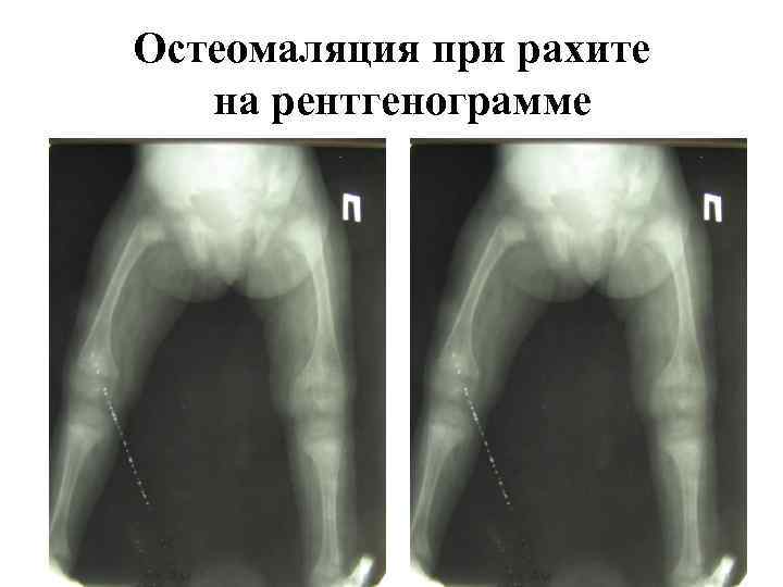 Костно суставная система