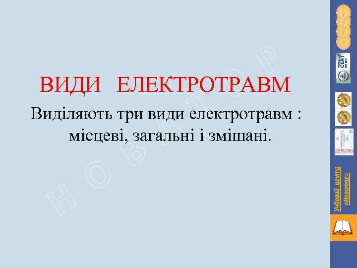 Р ВИДИ ЕЛЕКТРОТРАВМ О : Виділяють три види електротравм Тзмішані. місцеві, загальні і А