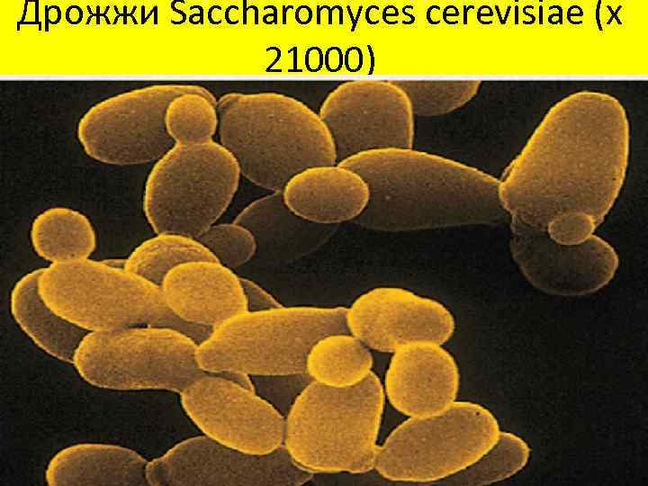 Дрожжи Saccharomyces cerevisiae (x 21000) 
