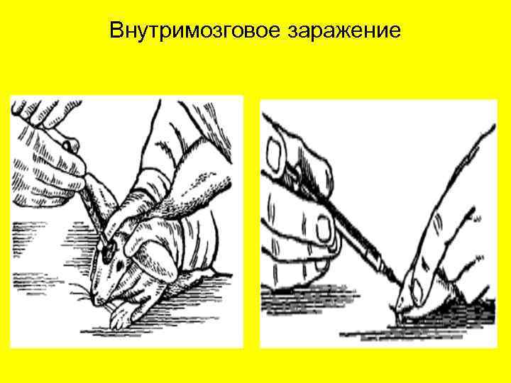 Внутримозговое заражение 