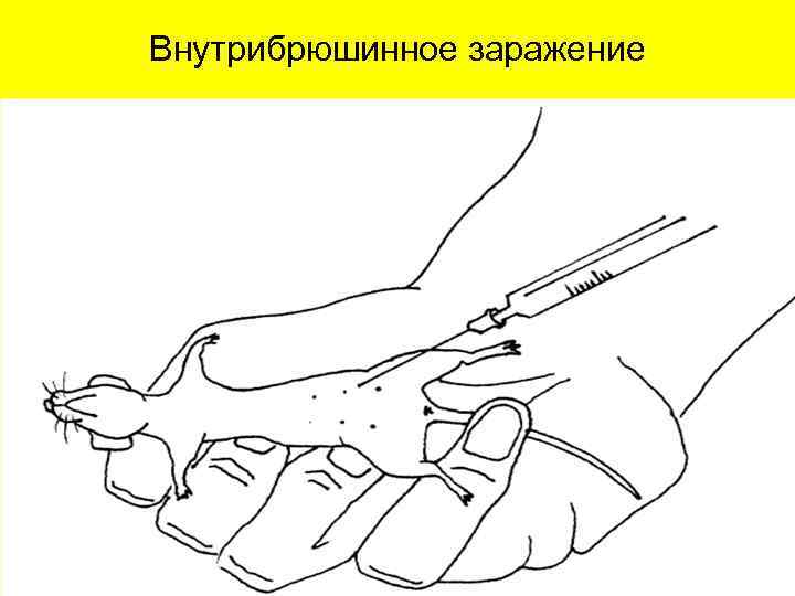 Внутрибрюшинное заражение 