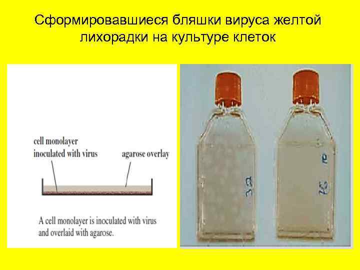 Сформировавшиеся бляшки вируса желтой лихорадки на культуре клеток 
