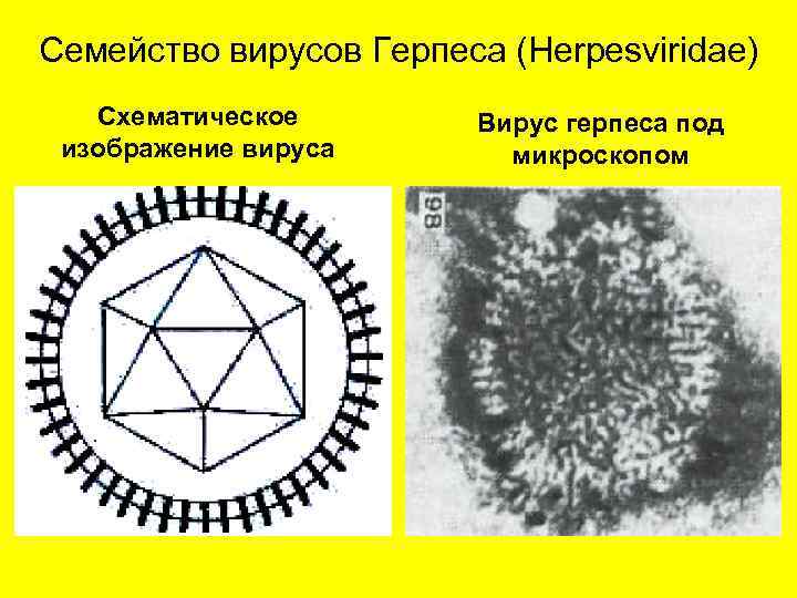 Семейство вирусов Герпеса (Herpesviridae) Схематическое изображение вируса Вирус герпеса под микроскопом 