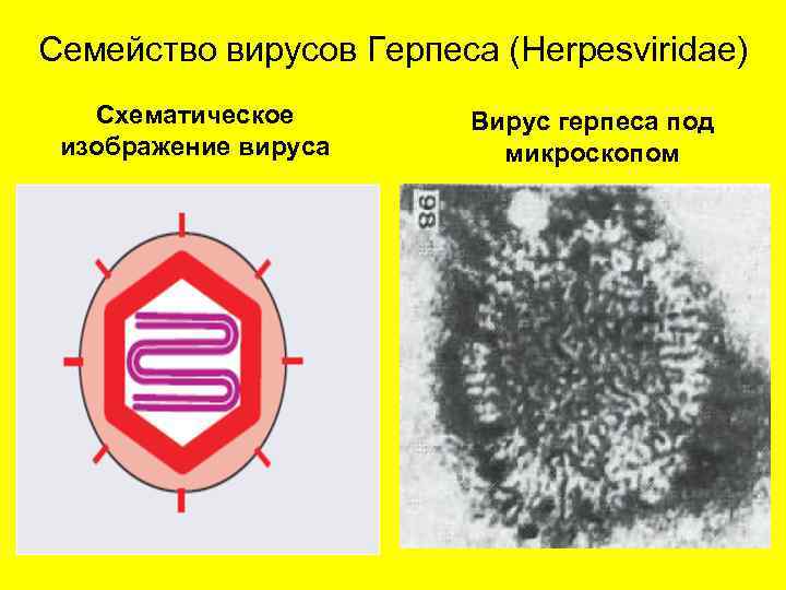 Семейство вирусов Герпеса (Herpesviridae) Схематическое изображение вируса Вирус герпеса под микроскопом 