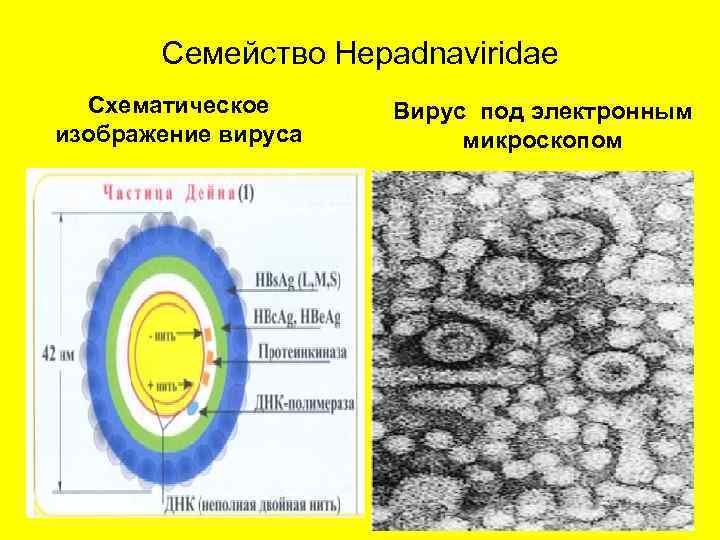 Семейство Hepadnaviridae Схематическое изображение вируса Вирус под электронным микроскопом 