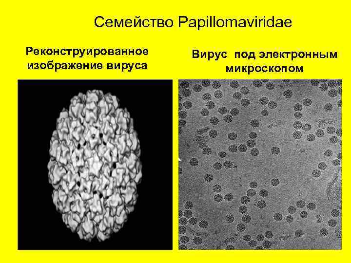 Семейство Pаpillomaviridae Реконструированное изображение вируса Вирус под электронным микроскопом 