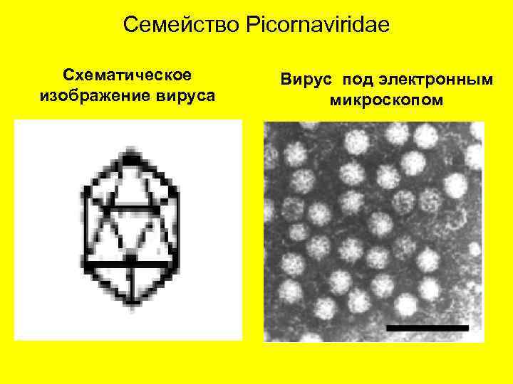 Семейство Picornaviridae Схематическое изображение вируса Вирус под электронным микроскопом 