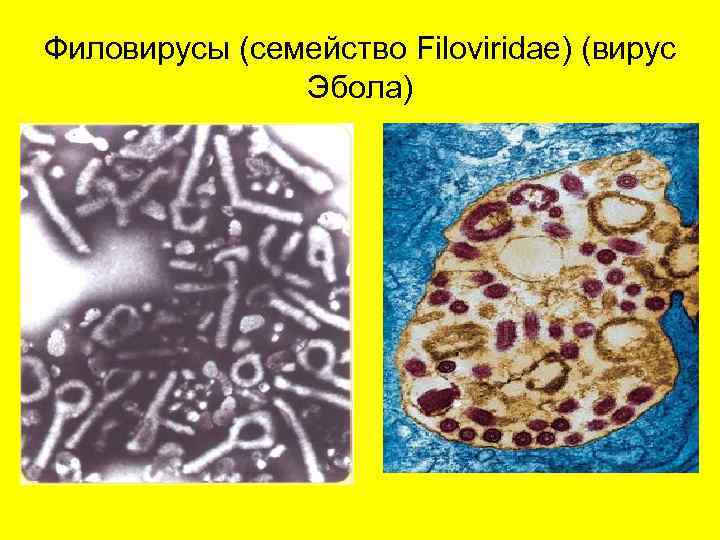 Филовирусы (семейство Filoviridae) (вирус Эбола) 