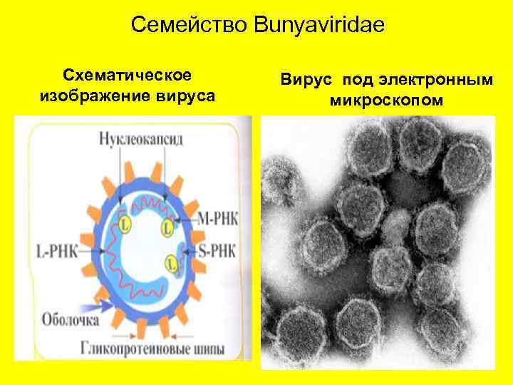 Семейство Bunyaviridae Схематическое изображение вируса Вирус под электронным микроскопом 